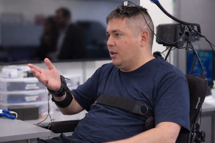 bypass neuronal dublu, Keith Thomas și-a recuperat 86% din forța brațului drept