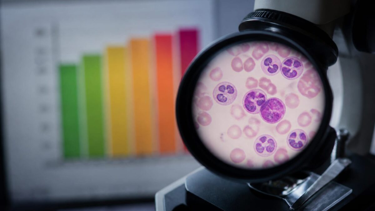 78% risc la 10 ani în grupul cu valori foarte ridicate. De ce medicii nu recomandă încă testarea persoanelor sănătoase