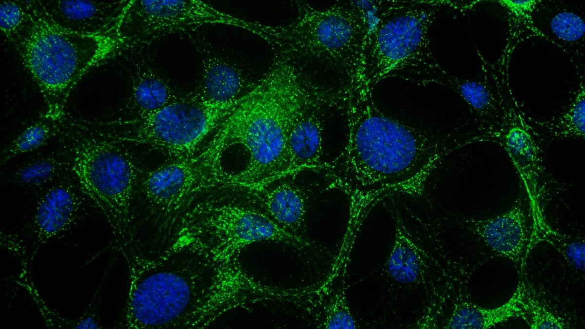 terapie glioblastom nanoparticule, O terapie cu nanoparticule a crescut cu 50% supraviețuirea la șoarecii cu glioblastom