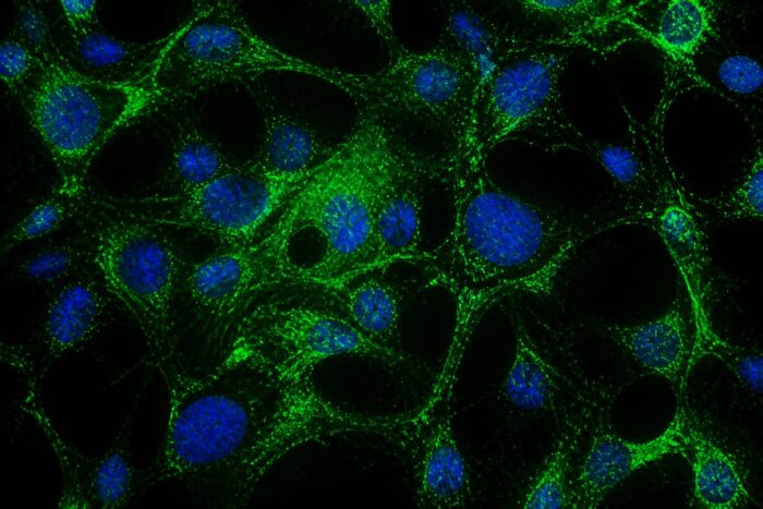 terapie glioblastom nanoparticule, O terapie cu nanoparticule a crescut cu 50% supraviețuirea la șoarecii cu glioblastom