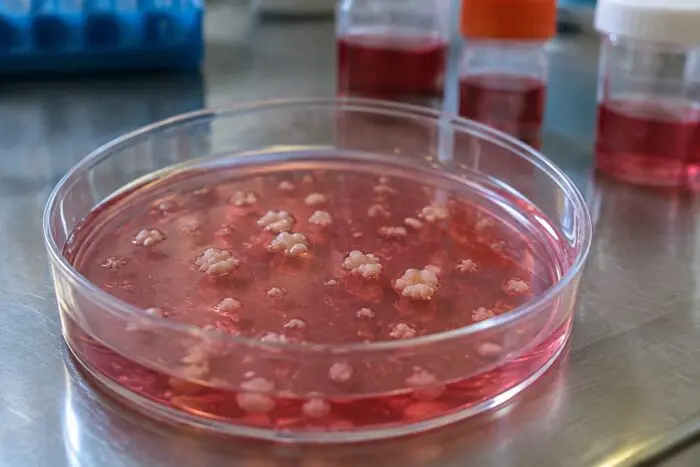 Culturi de cancer colorectal