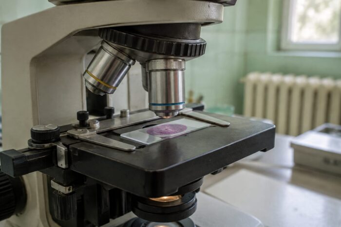 Probă de laborator cancer pancreatic