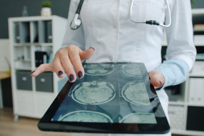 Analiză medicală pentru inflamație cerebrală