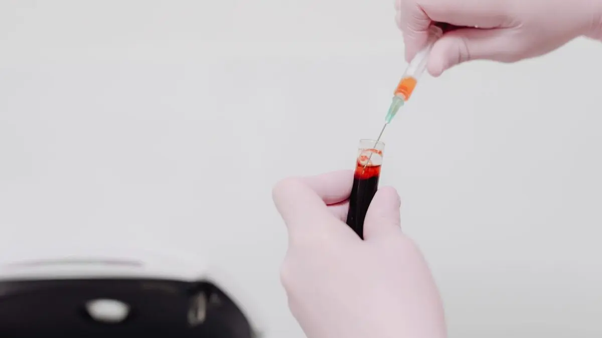 Test de sânge pentru traumatisme cerebrale