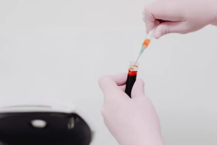 Test de sânge pentru traumatisme cerebrale